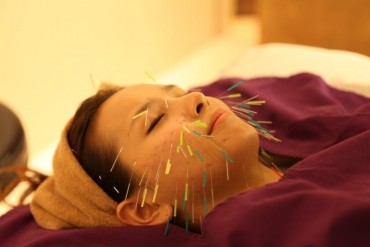 Acupuncture to Reduce Facial Wrinkles Proven Effective by Clinical Trial