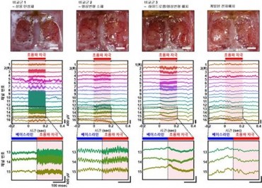 South Korean Scientists Develop Personalized ‘Electronic Medicine’ for Brain Disorders